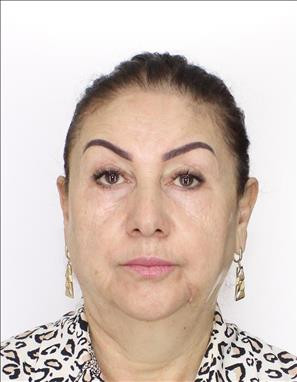 Madasheva Anajan GAZXANOVNA