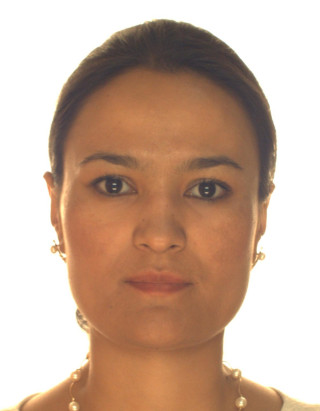Aslonova Lobar