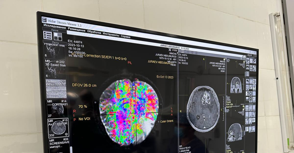 The method of intraoperative ultrasound neuronavigation was introduced into practice
