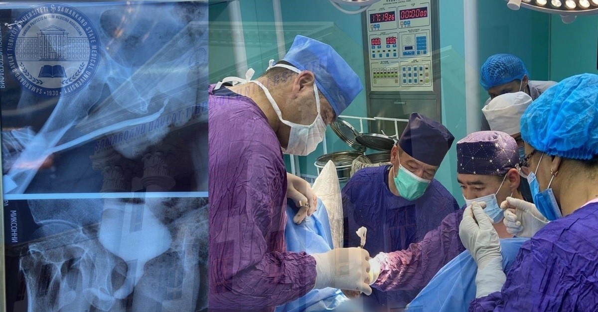 ​Complex urological surgery
