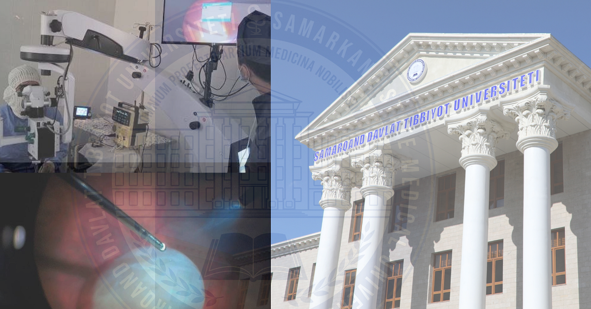 Complex eye surgery by the staff of Samarkand State Medical University