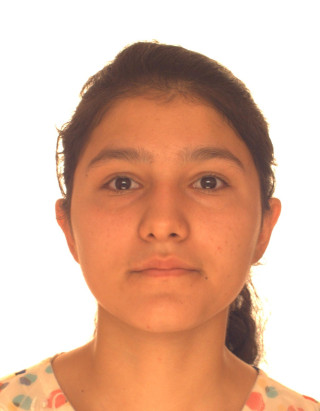 Kazakova Lobar